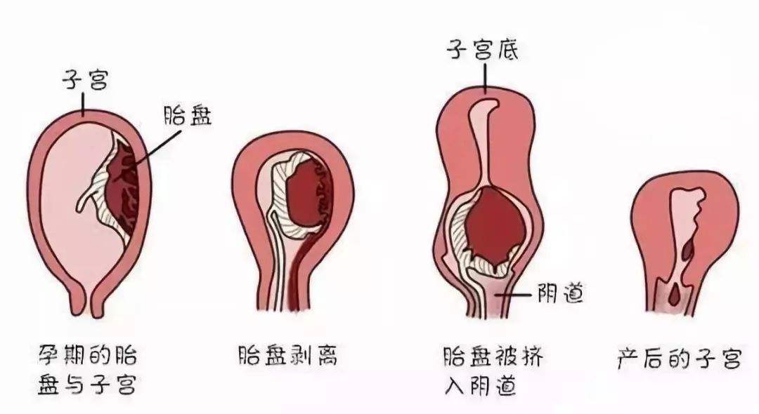 流产手术后可以喝红糖水吗?