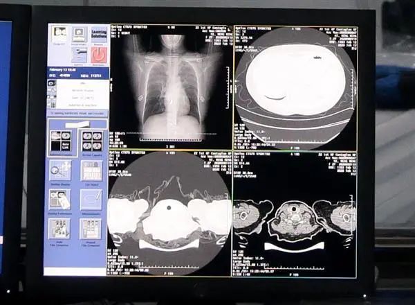 ct人工智能诊断什么原理