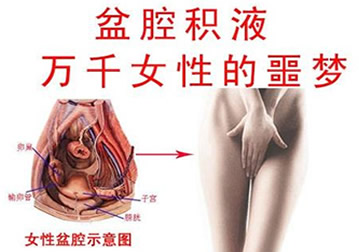 女性盆腔积液是什么原因造成的