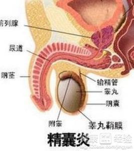 精囊炎的原因